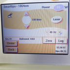 Refurbished 2008 Cynosure SmartLipo MPX Body Sculpt System Non-RFIDZ RX8A4706