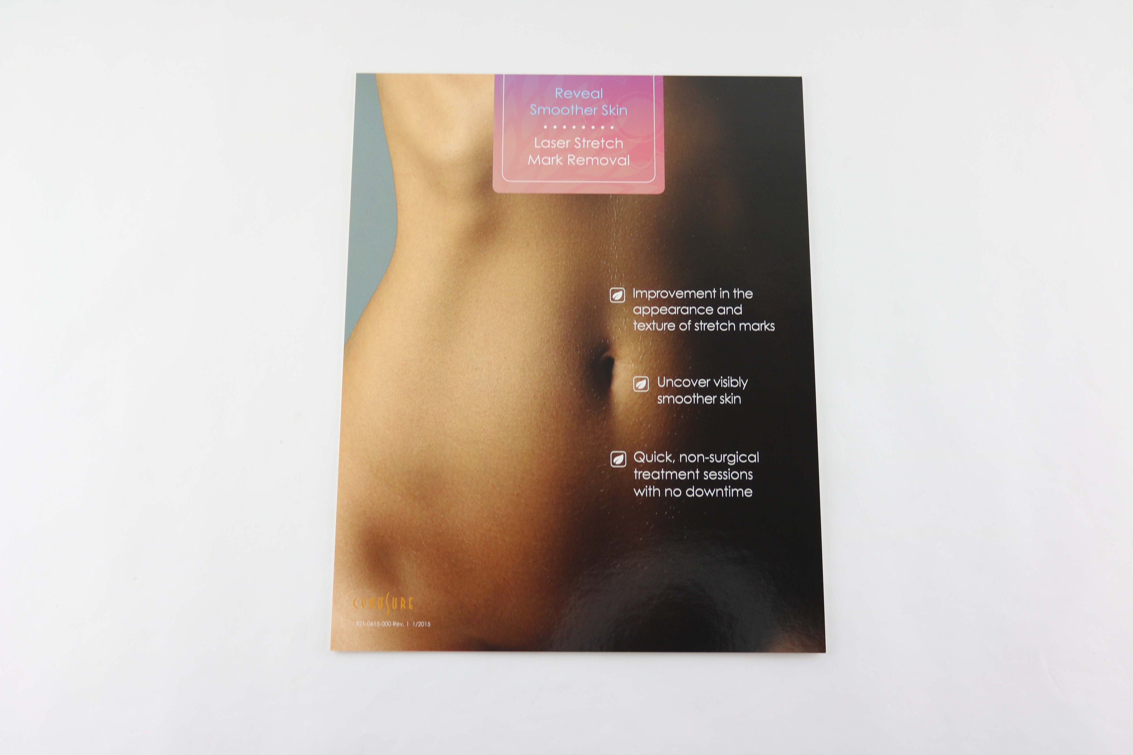 Cynosure ICON Reveal Smoother Skin Laser Stretchmark Removal Sign Display 8.5x11