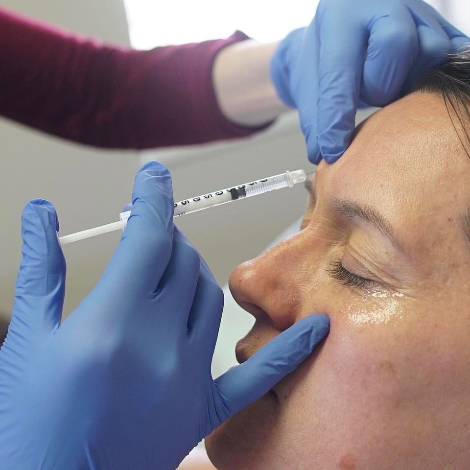 Cosmetic Injectables: Neurotoxin