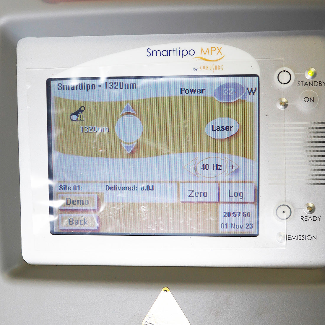 Never Used 2015 Cynosure SmartLipo MPX Body Sculpt NON-RFID Laser System