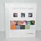 Cutera Xeo Laser Before After Office Photo Patient Treatment Book Consult Guide