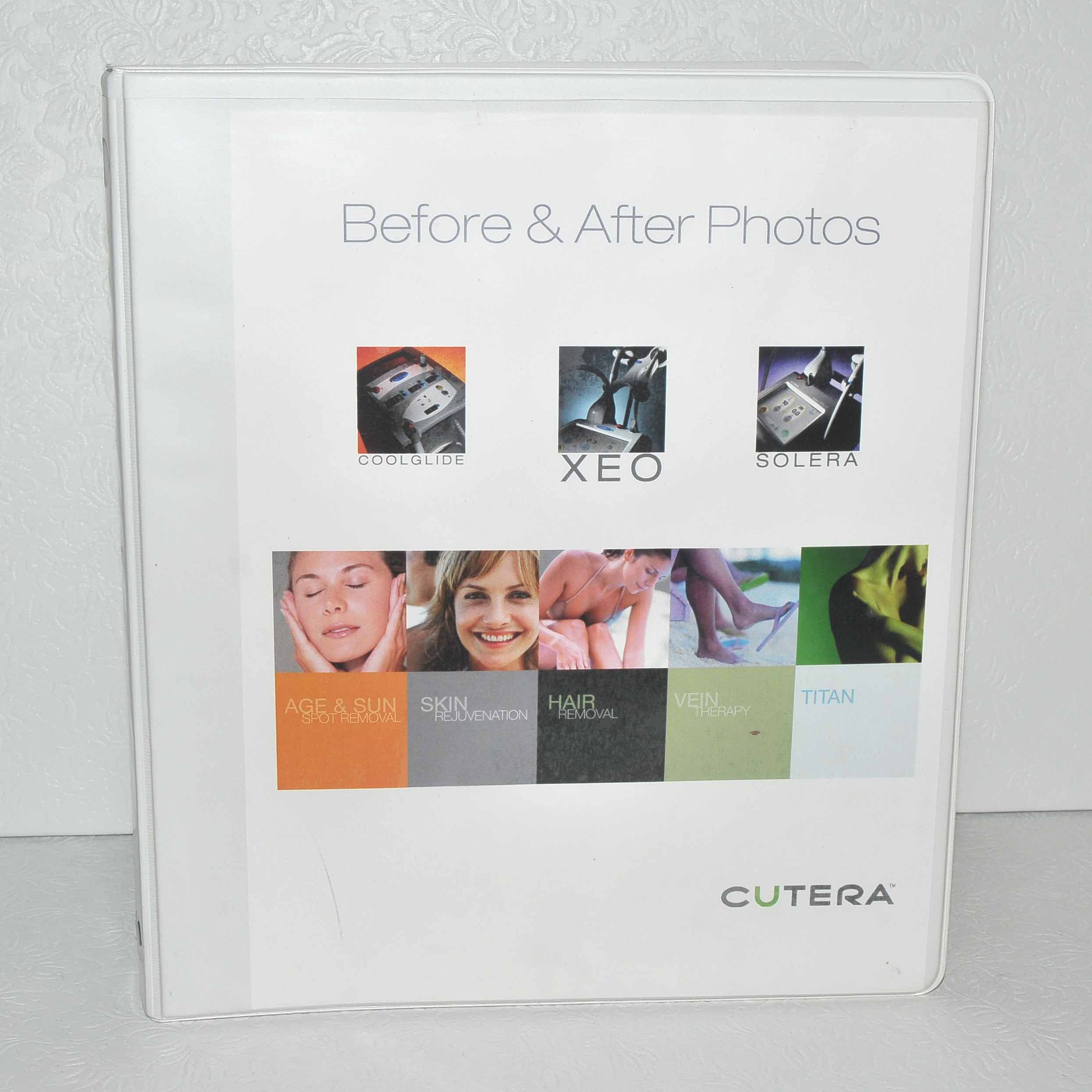 Cutera Xeo Laser Before After Office Photo Patient Treatment Book Consult Guide