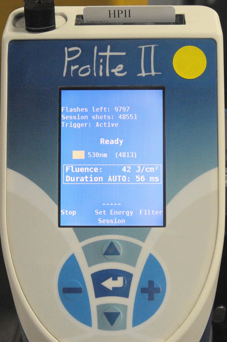 2006 Prolite II IPL Quantel Laser Skin Treatment System ** AS-IS PARTS UNIT **