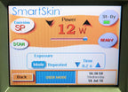 2008 Cynosure SmartSkin 30 Watt Affirm CO2 Ablative Wrinkle C02 Laser Smart Skin