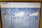 2009 Reliant FRAXEL SR1500 Laser System Ablative Skin Rejuvenation