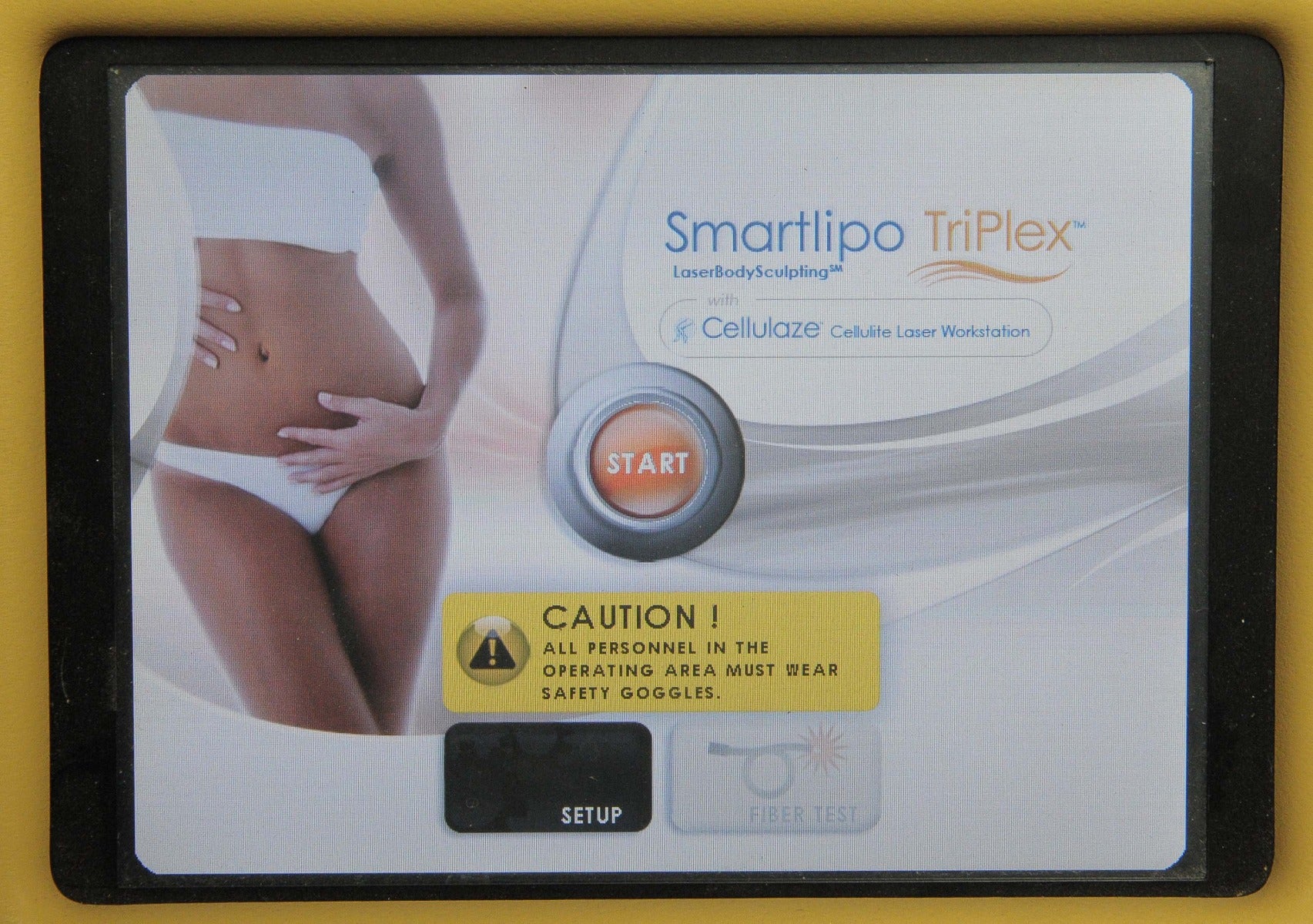 2011 Cynosure Triplex SmartLipo Nd: Yag Laser System SLT II 1064nm 1320nm 1440nm 1