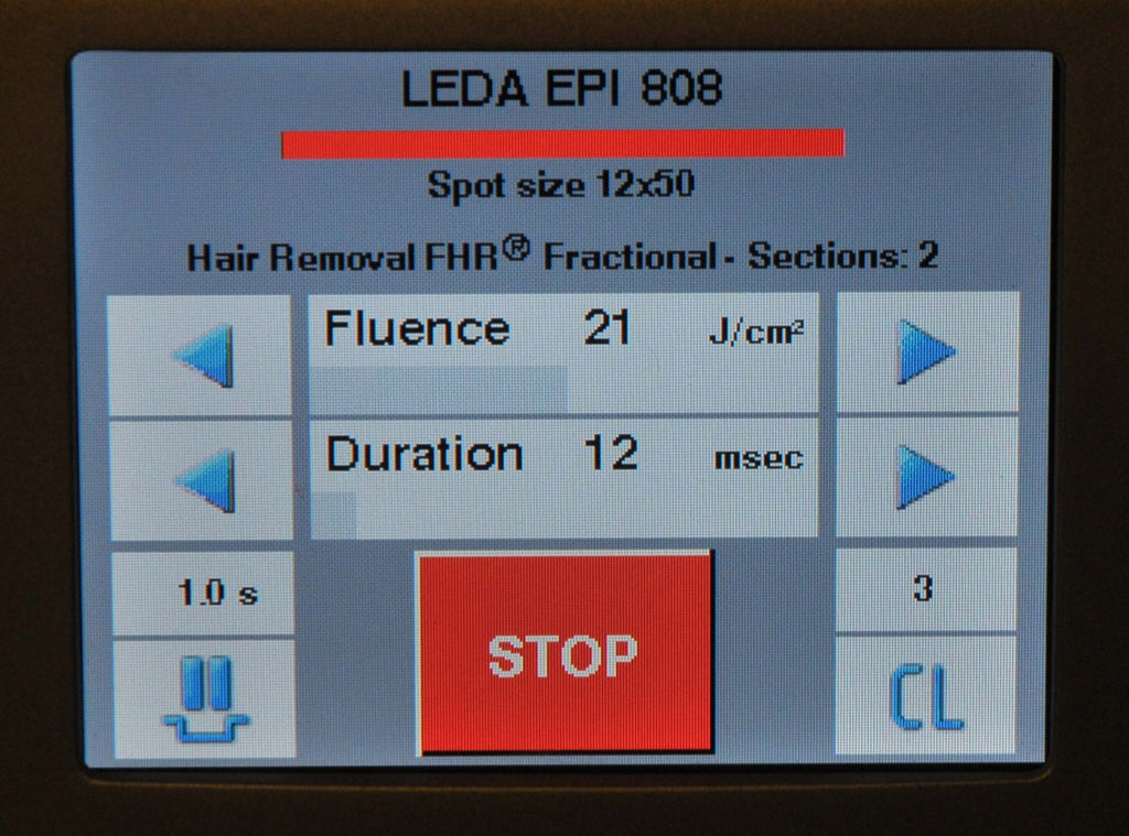 2012 Quantel Derma LEDA Table Diode Laser EPI 808 810 nm Hair Removal Fractional