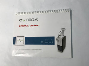2013 Cutera Lasers TruSculpt RF Treatment Before & After Patient Photobook REV A