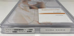 2014 Cynosure Palomar Triplex Smartlipo SLT II Cellulaze Laser System