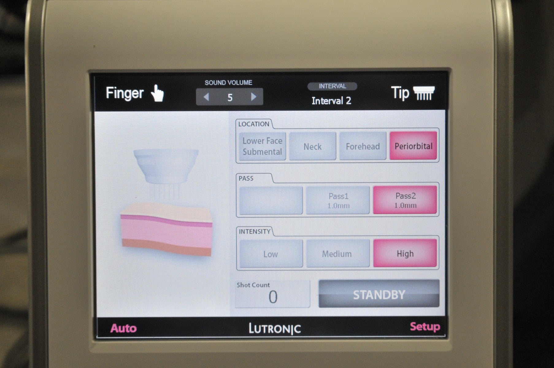 2015 Lutronic Infini Radio Frequency Microneedling RF Micro Needling Needle
