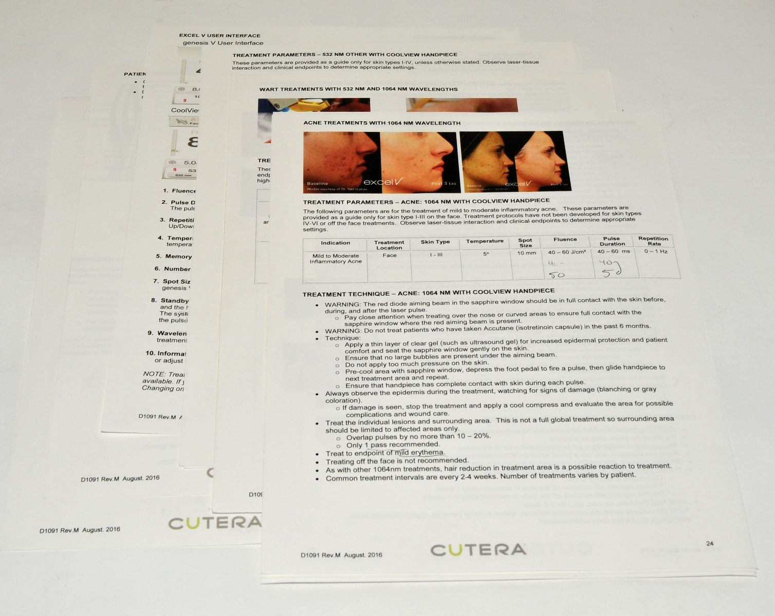2016 Cutera Excel V Laser CLINICAL TRAINING GUIDE Vascular Manual – D1091 ExcelV
