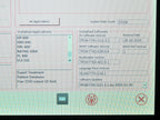 2019 Candela Nordlys Ellipse IPL Laser Hair Removal Vascular Lesions Rosacea
