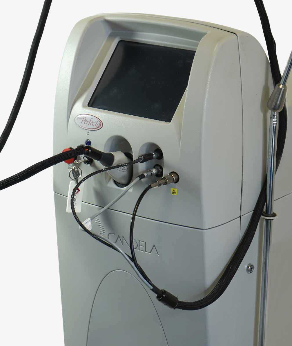 Candela VBeam Perfecta Pulsed Laser NEW DYE KIT Vascular Acne Vein 595 nm V Beam