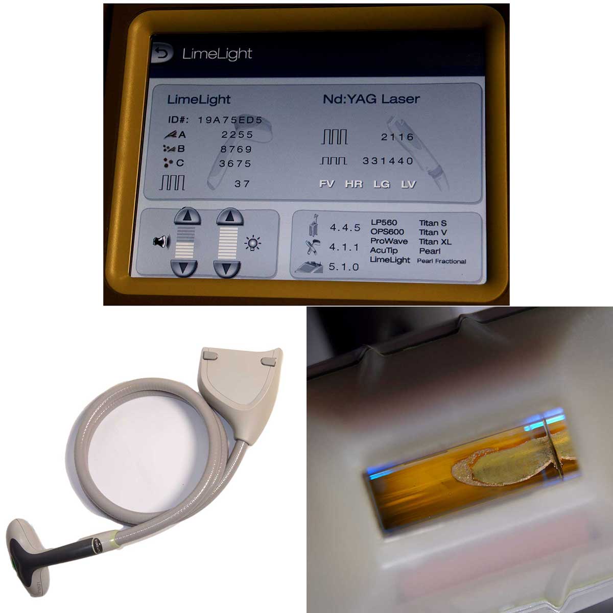 2017 Cutera Xeo Skin Resurfacing Nd:YAG Laser LimeLight Prowave LX Hair Removal