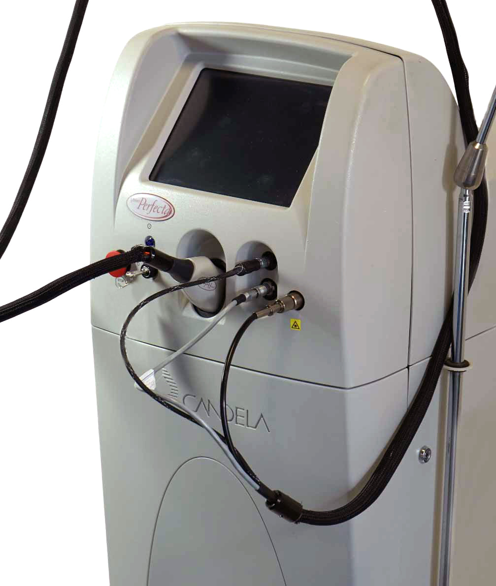 2007 Candela VBeam Perfecta Pulsed Laser Vascular Acne Vein 595 nm V Beam