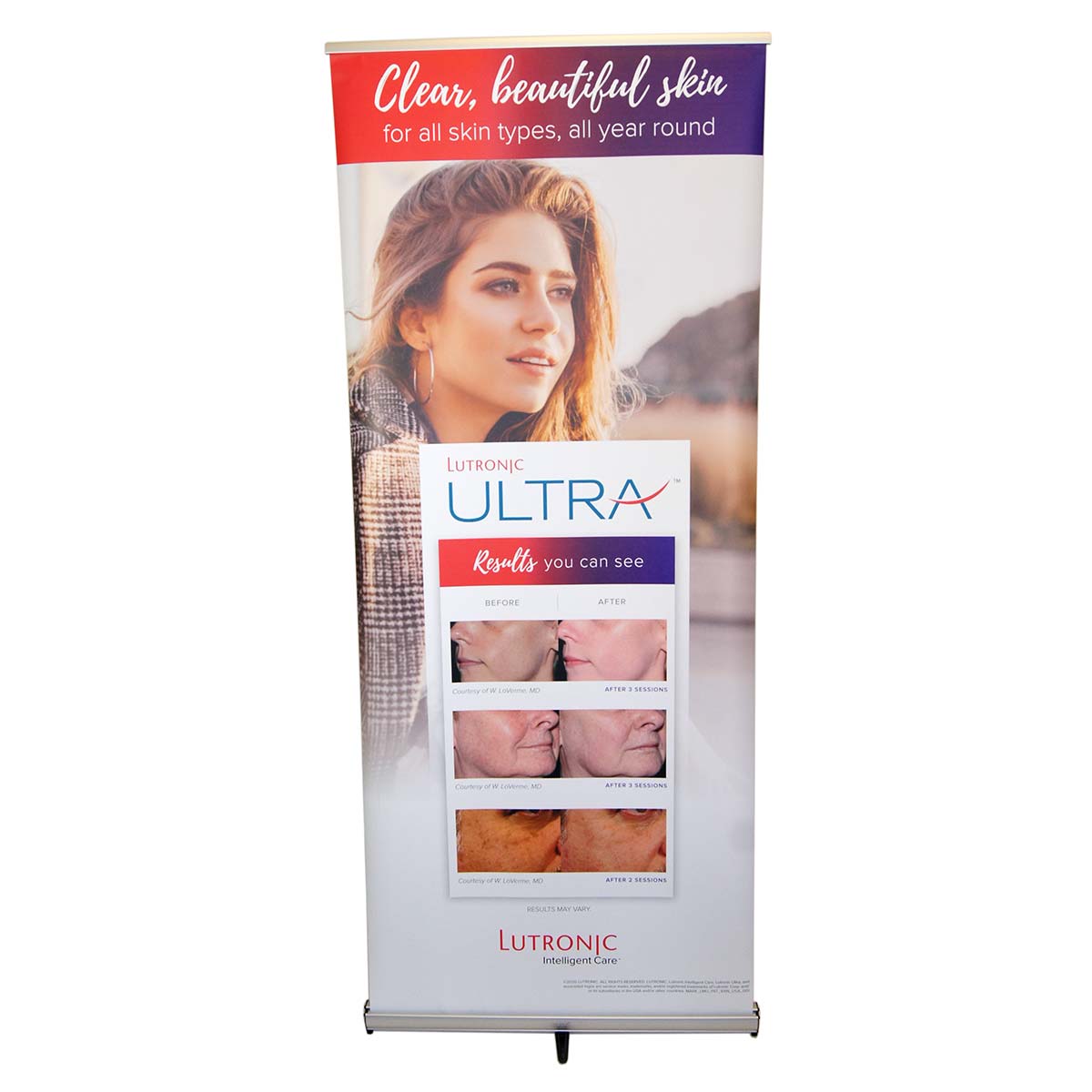Lutronic Ultra 'Clear, Beautiful Skin' Before/After Marketing Banner 34in x 81in
