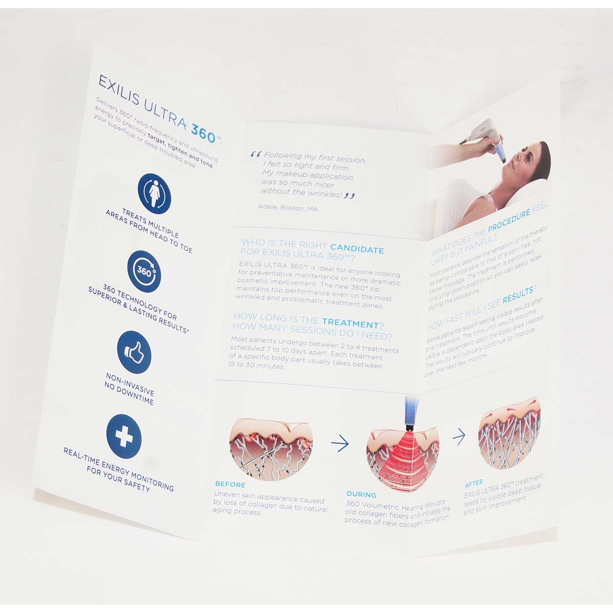BTL Exilis Ultra 360 Astonishing From Every Angle Marketing Info Pamphlet 49pk