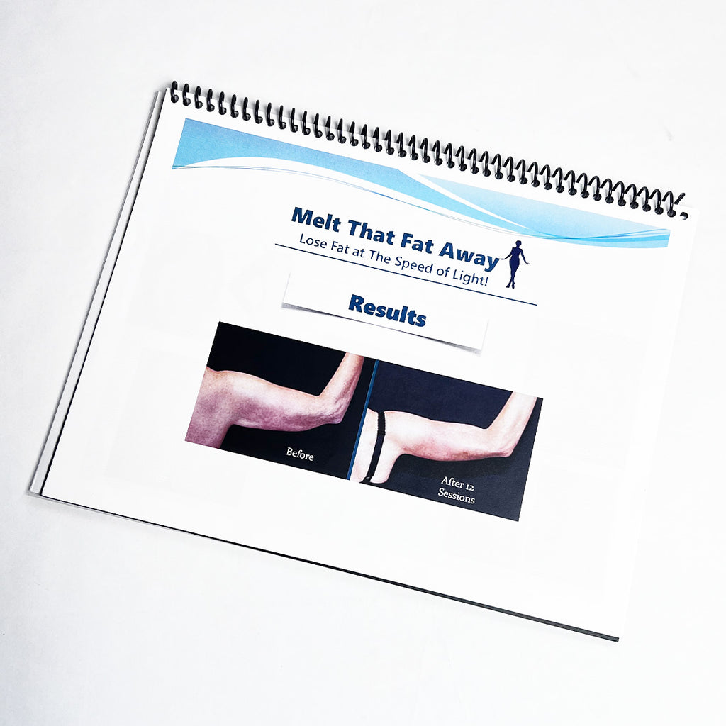 IdealLight LipoMelt "Melt That Fat Away" Consulting Brochure Before After Photos