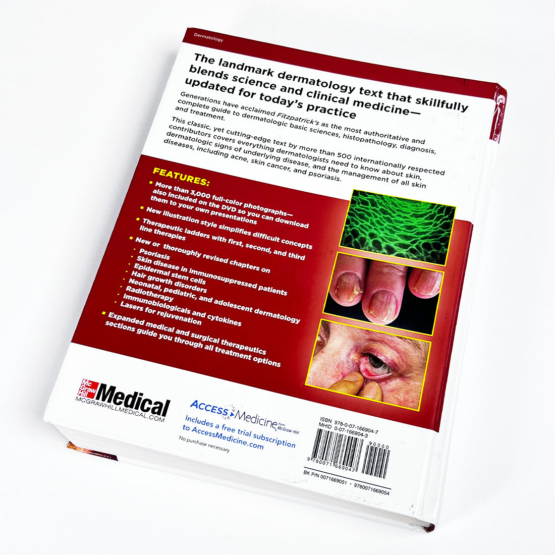 Fitzpatrick's Dermatology in General Medicine 8th Edition Hardcover Volume One