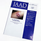 JAAD Magazine Thermotherapy in Dermatologic Infections June 2010 V62 #6 909-1120