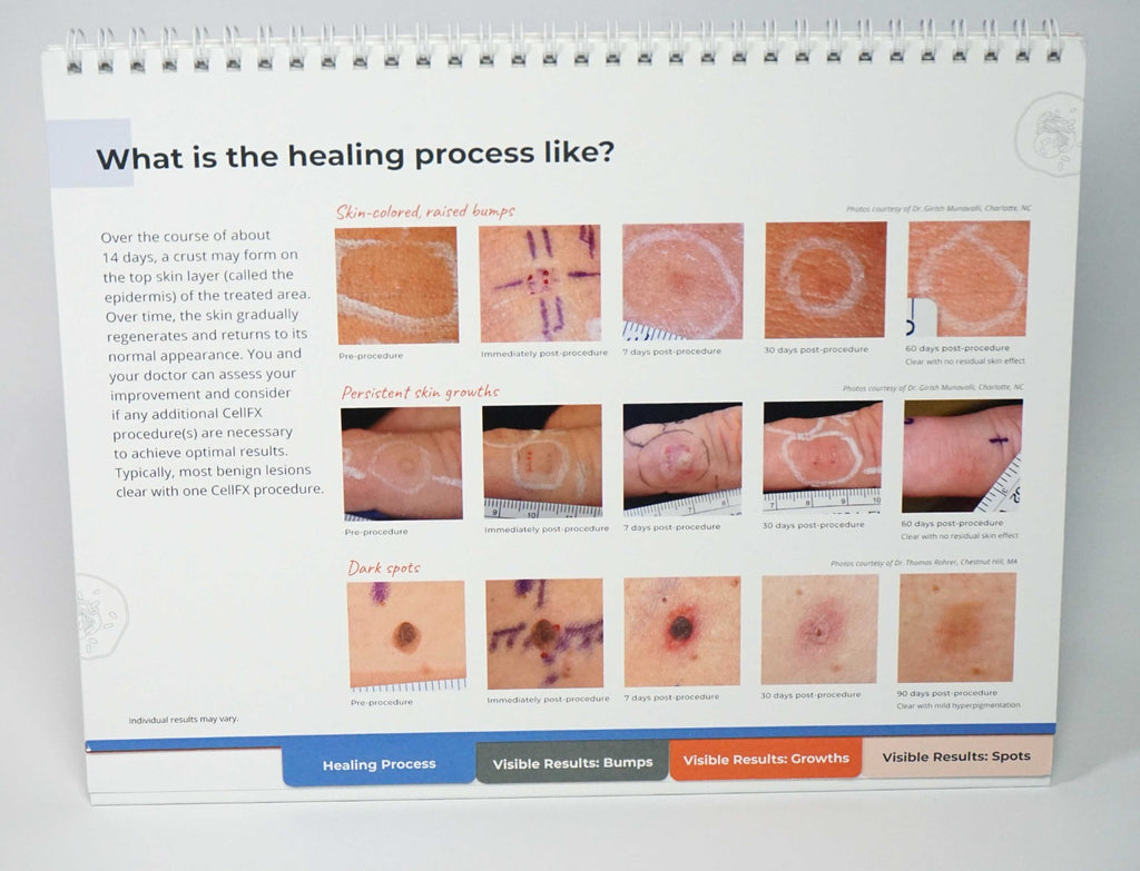 Pulse Biosciences CellFX Office Counter Merchandising Brochure Consulting Guide