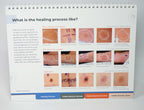 Pulse Biosciences CellFX Office Counter Merchandising Brochure Consulting Guide