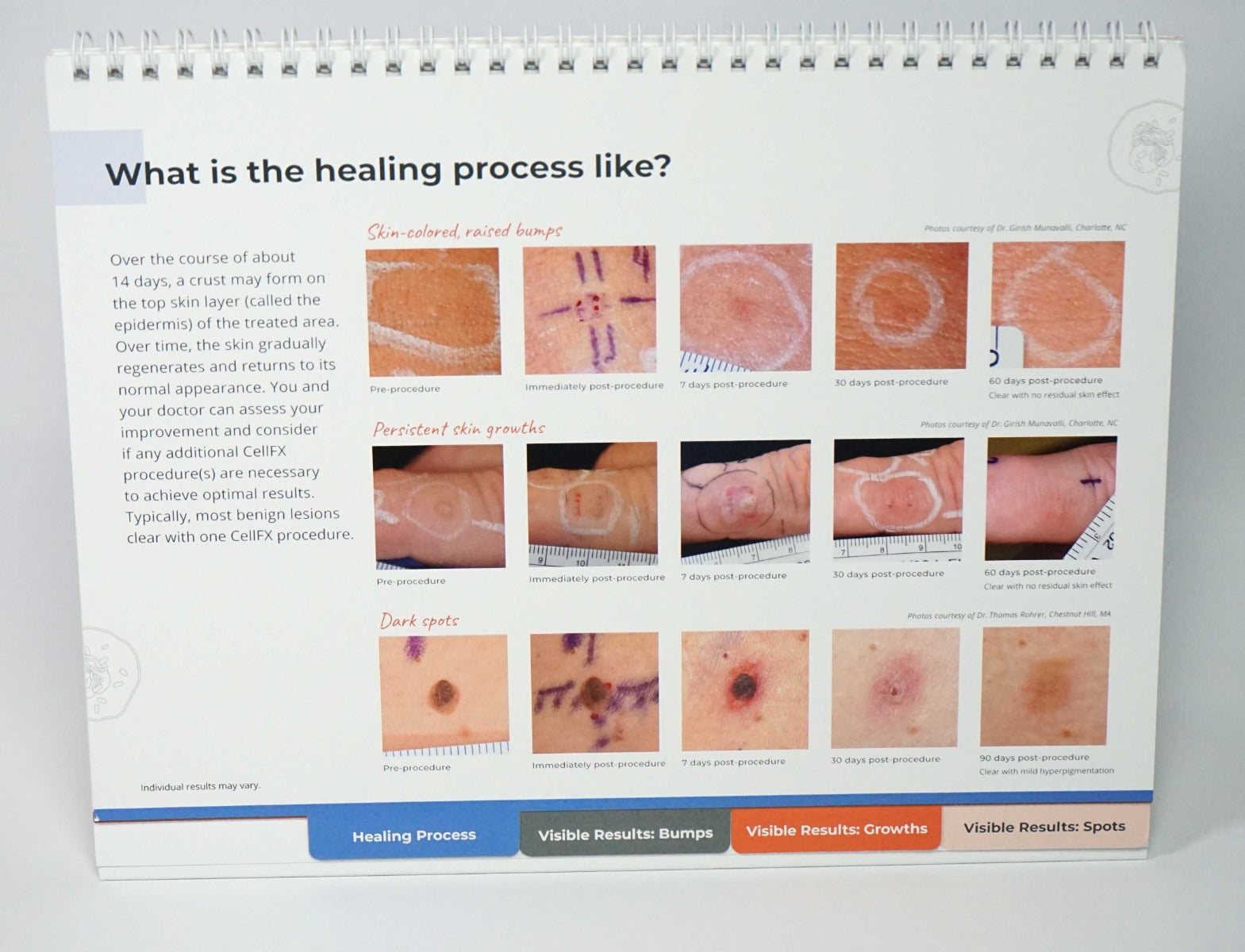 Pulse Biosciences CellFX Office Counter Merchandising Brochure Consulting Guide