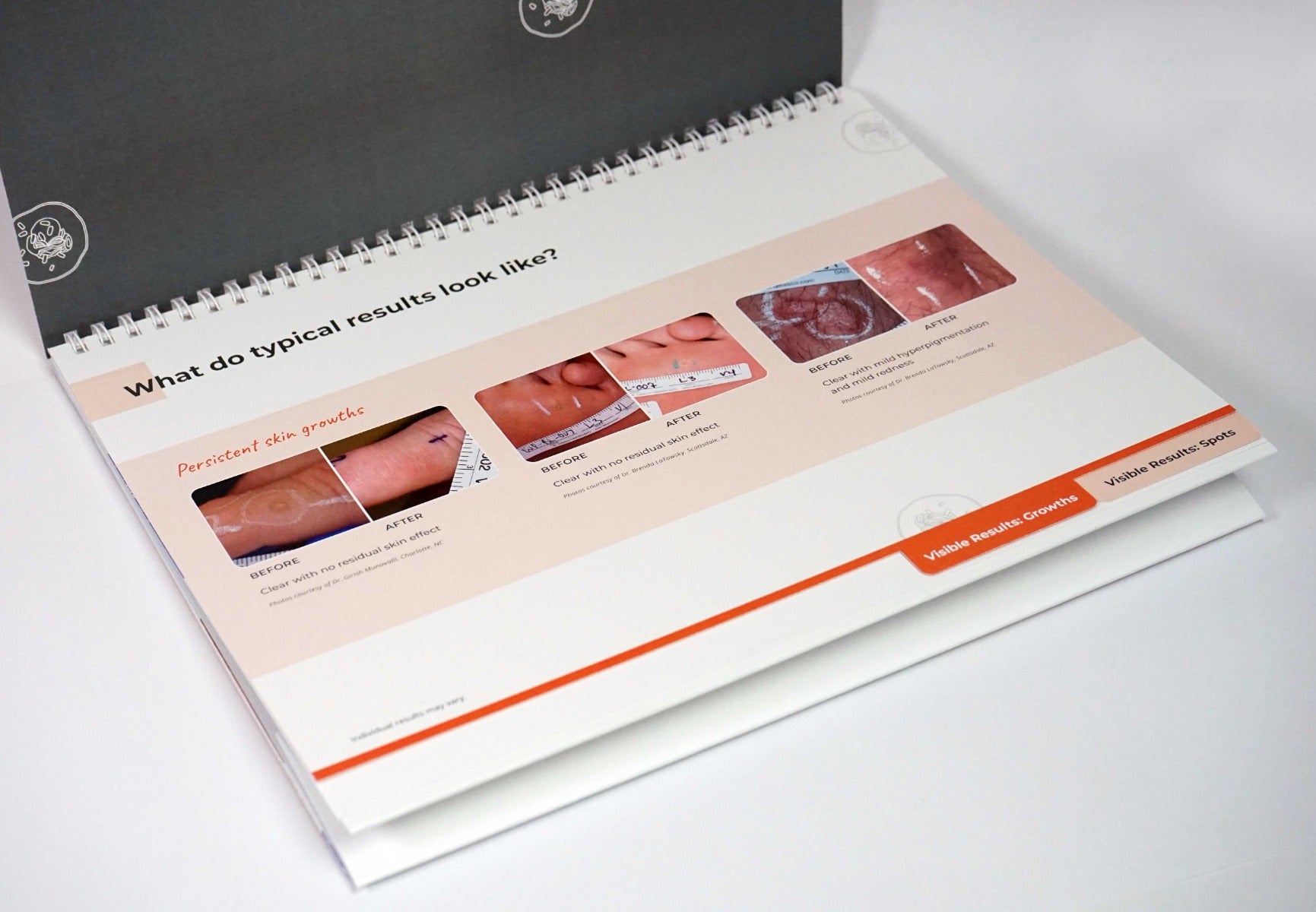 Pulse Biosciences CellFX Office Counter Merchandising Brochure Consulting Guide