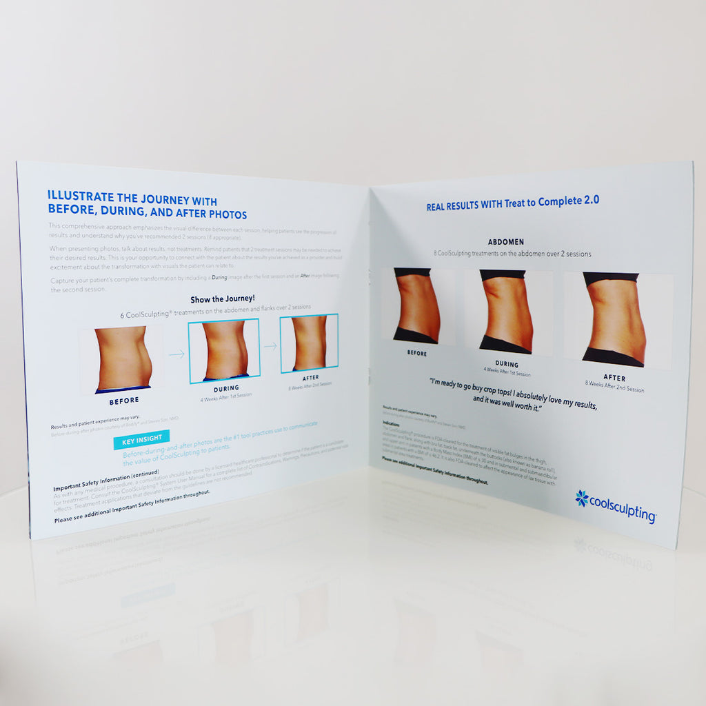 Zeltiq Coolsculpting Treat To Complete 2.0 Marketing Guide CSC145640