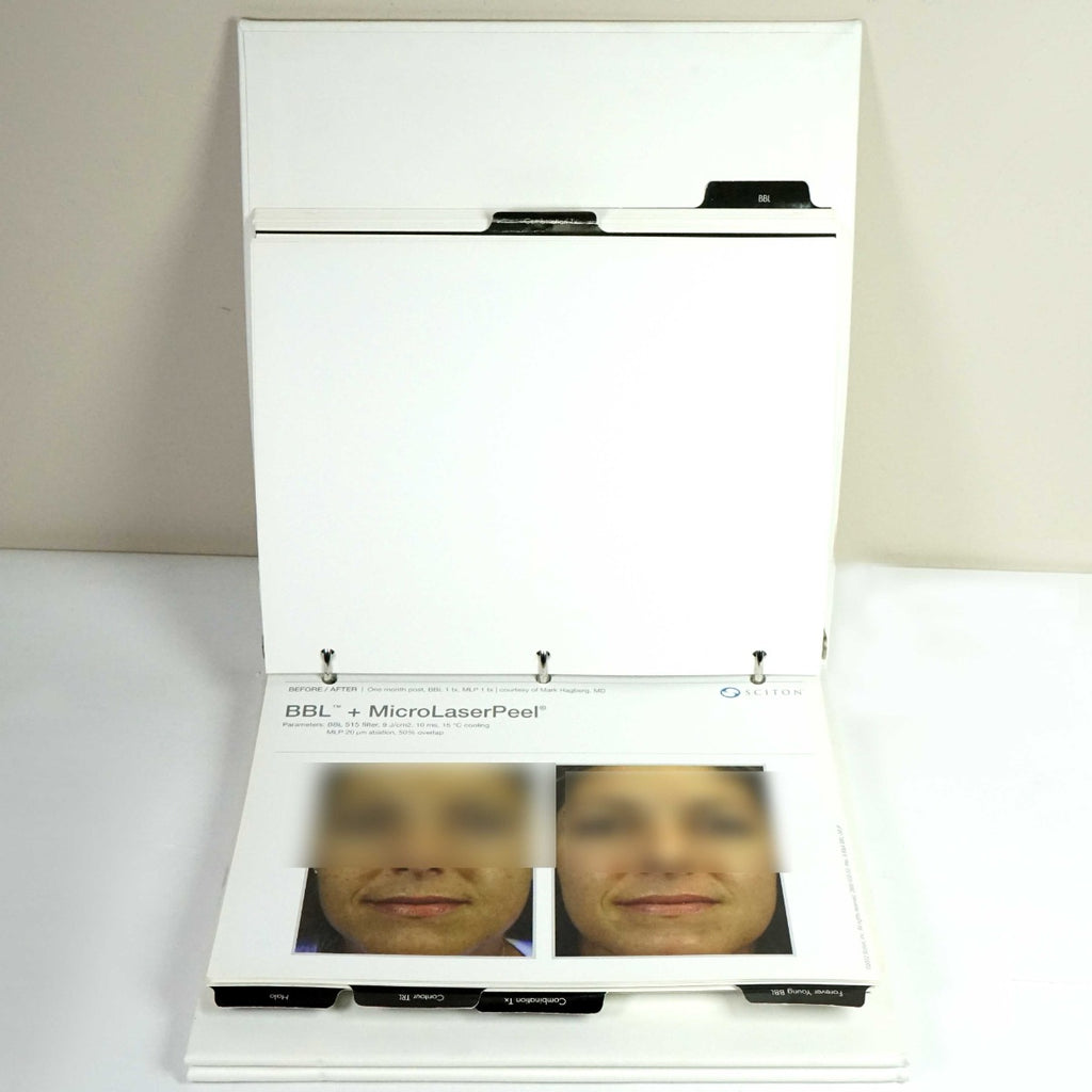 Sciton Laser BECAUSE RESULTS MATTER BBL Halo Contour Patient Before After Photos