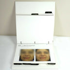 Sciton Laser BECAUSE RESULTS MATTER BBL Halo Contour Patient Before After Photos