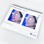 Lumenis Stellar M22 Laser Clinical CaseBook Office Patient Before After Photos