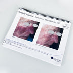 Lumenis Stellar M22 Laser Clinical CaseBook Office Patient Before After Photos