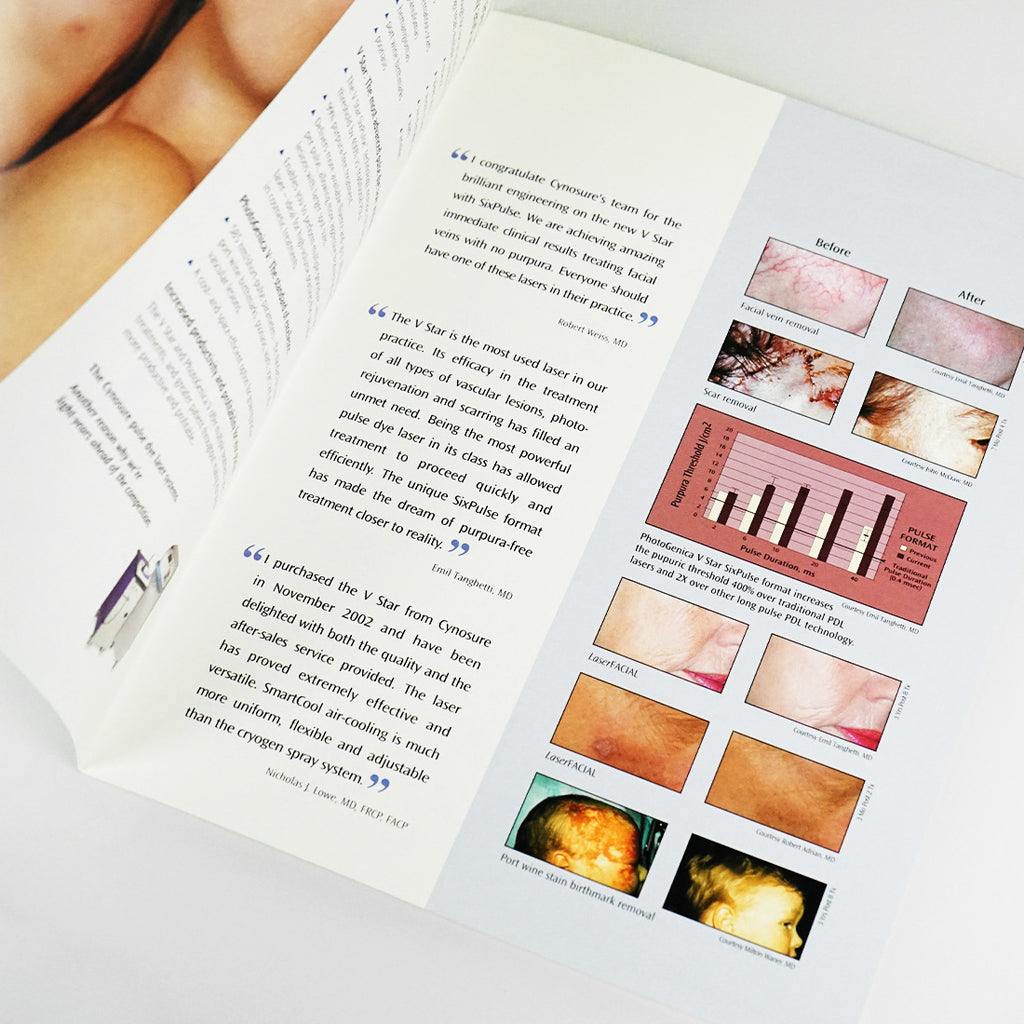 Cynosure V Star PhotoGenica Pulse Dye Laser Marketing Office Brochure VStar