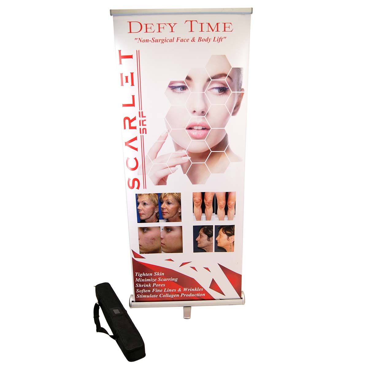 Scarlet SRF Defy Time MicroNeedling Office Marketing Display Banner 34in x 82in