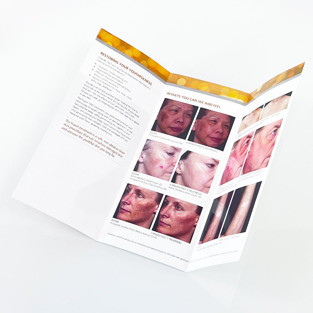 Fraxel 1927 "RADIANT SKIN CAN BE YOURS" Skin Resurfacing Office Brochure x12 Pcs