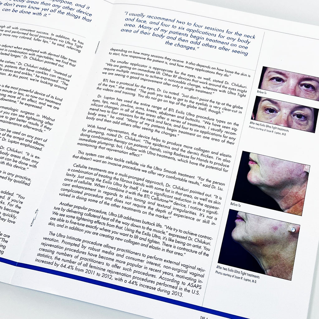 BTL The Aesthetic Guide BTL Supplement Magazine BTL Exilis Ultra Articles
