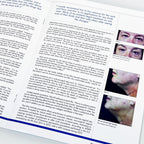 BTL The Aesthetic Guide BTL Supplement Magazine BTL Exilis Ultra Articles