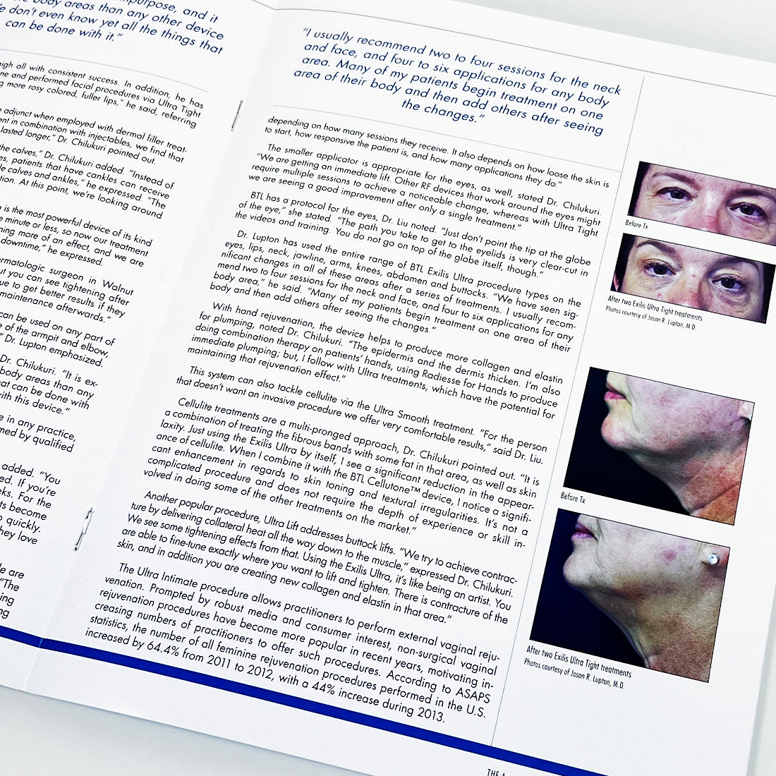 BTL The Aesthetic Guide BTL Supplement Magazine BTL Exilis Ultra Articles