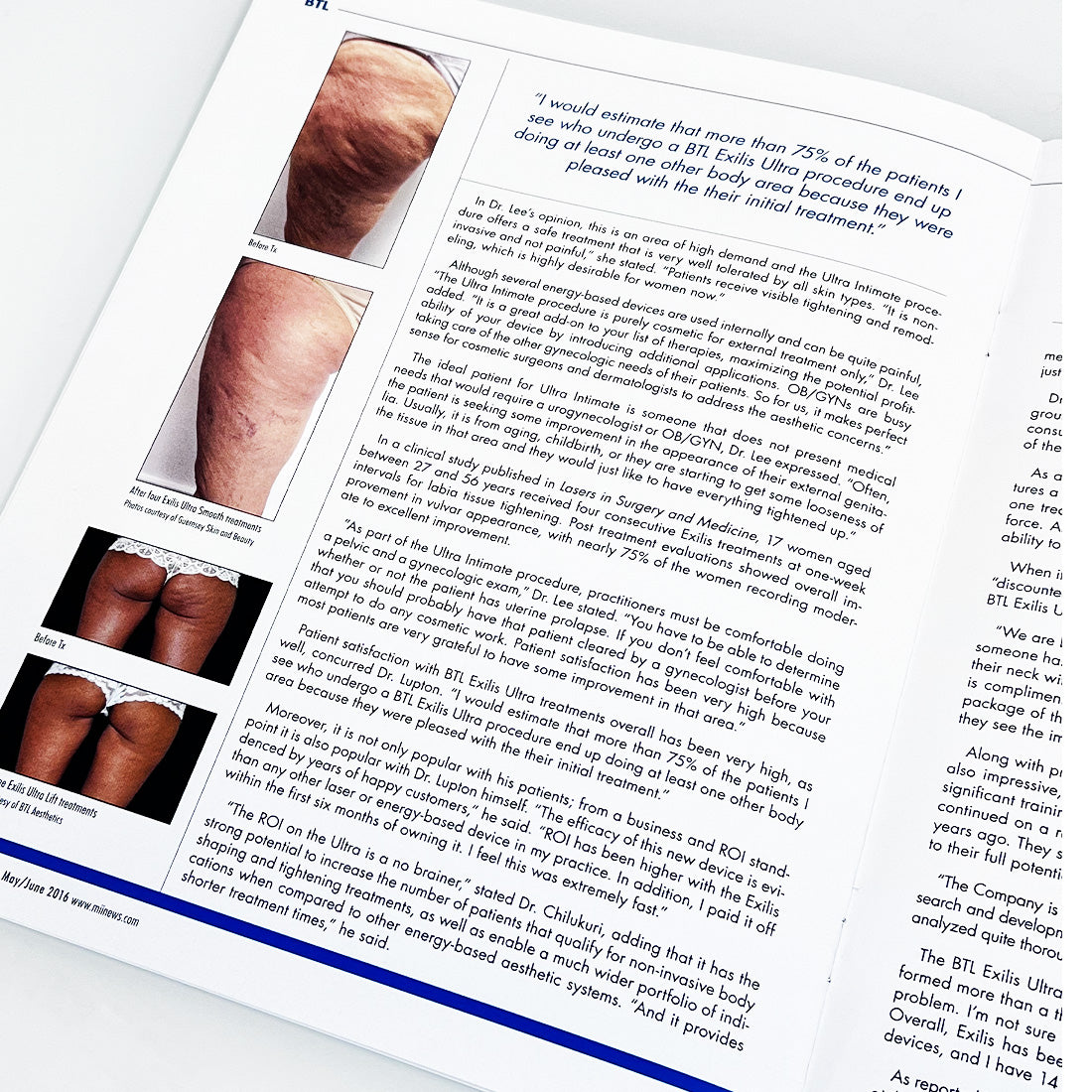 BTL The Aesthetic Guide BTL Supplement Magazine BTL Exilis Ultra Articles