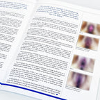 BTL The Aesthetic Guide BTL Supplement Magazine BTL Exilis Ultra Articles
