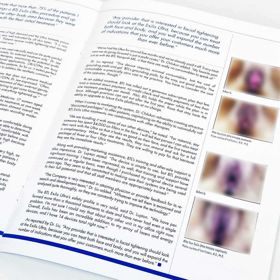 BTL The Aesthetic Guide BTL Supplement Magazine BTL Exilis Ultra Articles