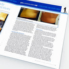 BTL Supplement to Modern Aesthetics Magazine May/June 2016 Vanquish ME Articles
