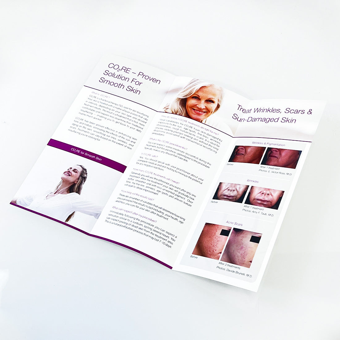 Syneron Candela CO2RE Treat Wrinkles Sun-Damaged Skin and Scars Pamphlet 10-Pack