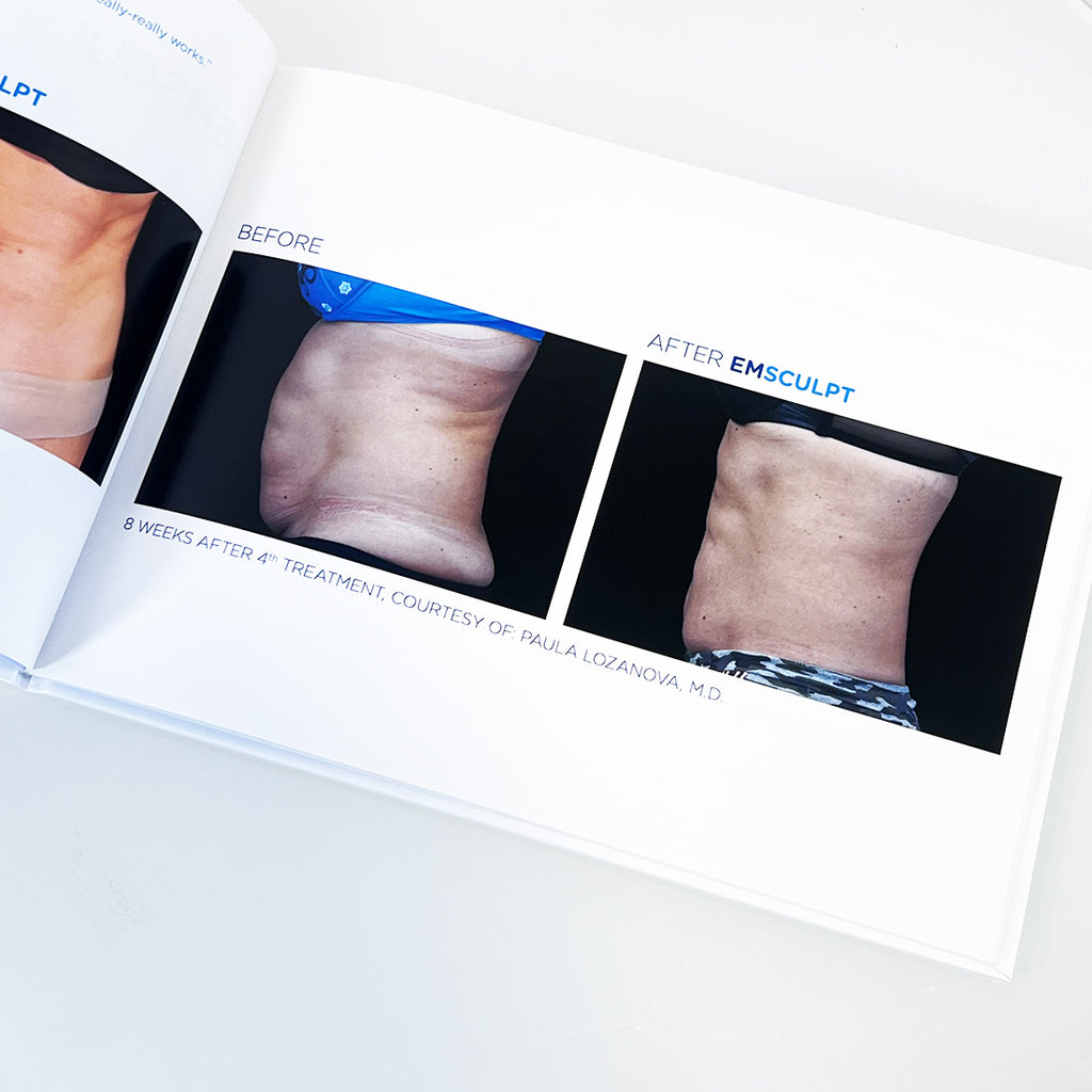 BTL EmSculpt "Build Muscle & Sculpt Your Body" Before After Photos Office Book