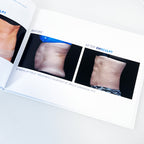 BTL EmSculpt "Build Muscle & Sculpt Your Body" Before After Photos Office Book
