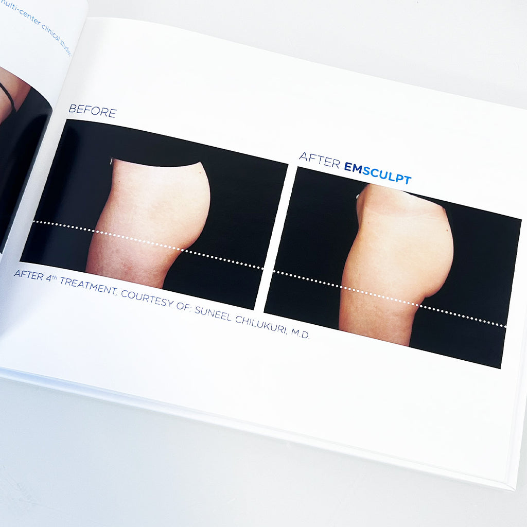 BTL EmSculpt "Build Muscle & Sculpt Your Body" Before After Photos Office Book