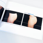 BTL EmSculpt "Build Muscle & Sculpt Your Body" Before After Photos Office Book