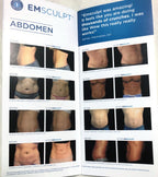 BTL EMSculpt Build Muscle & Sculpt Your Body Brochure 799-75EMCTATENS100 10-Pack