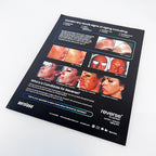 Aerolase REVERSE Correct Prevent Skin Aging Neo Era Elite Sheet Marketing Office
